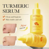 BIOAQUA Anti-Oxidation Acne Removal Turmeric Face Serum- 30ml
